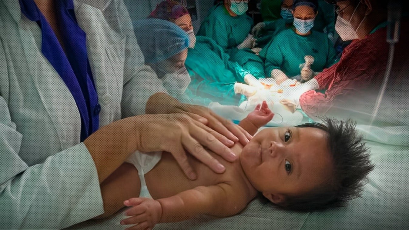 Nicaragua líder en Cirugía Fetal Intrauterina a nivel Internacional