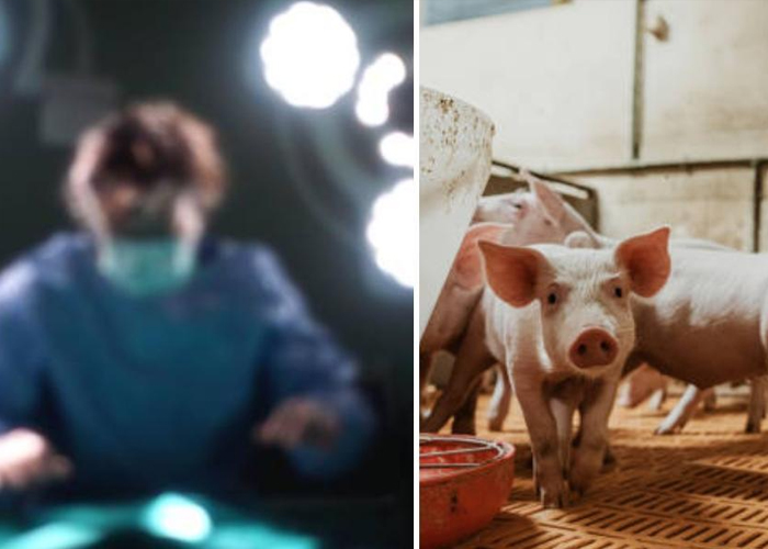 China realiza el primer trasplante de riñón de cerdo en una persona