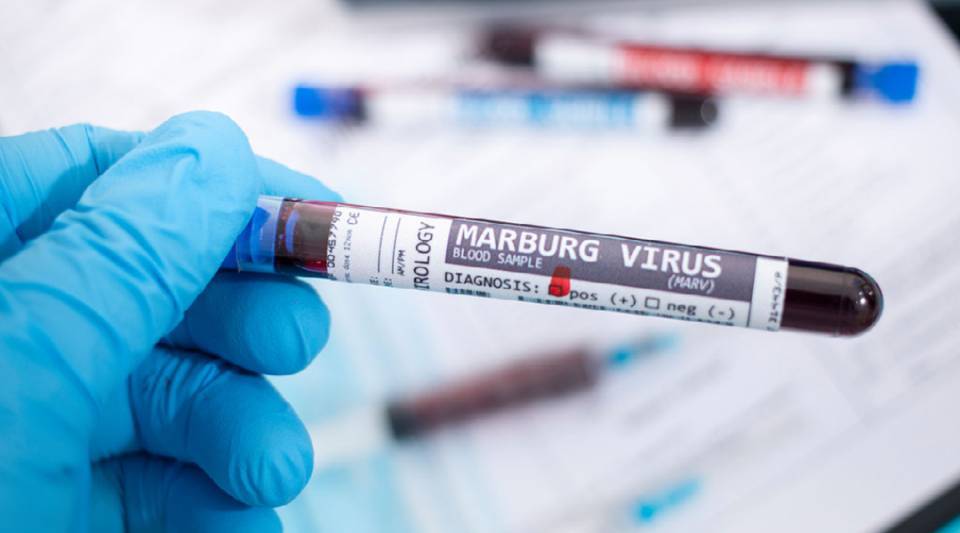 La OMS advierte sobre el brote del virus de Marburgo